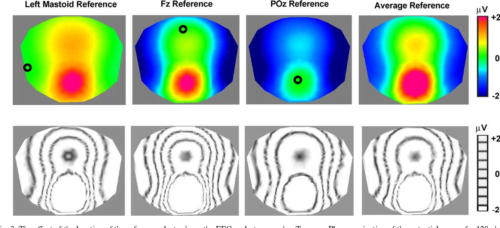 Brain imaging eeg